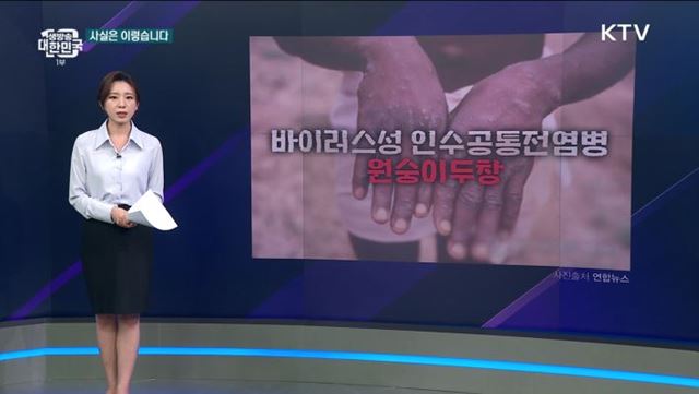 원숭이두창 예방 위해 사람두창 백신 맞아야 하나? [사실은 이렇습니다]