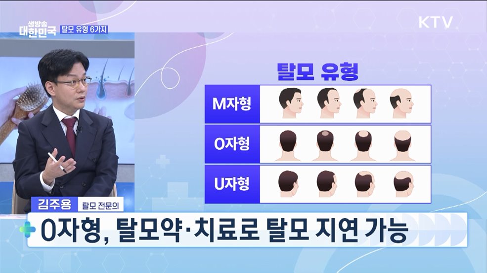 나이 가리지 않는 고민 '탈모' 예방과 치료법은? [건강 365]